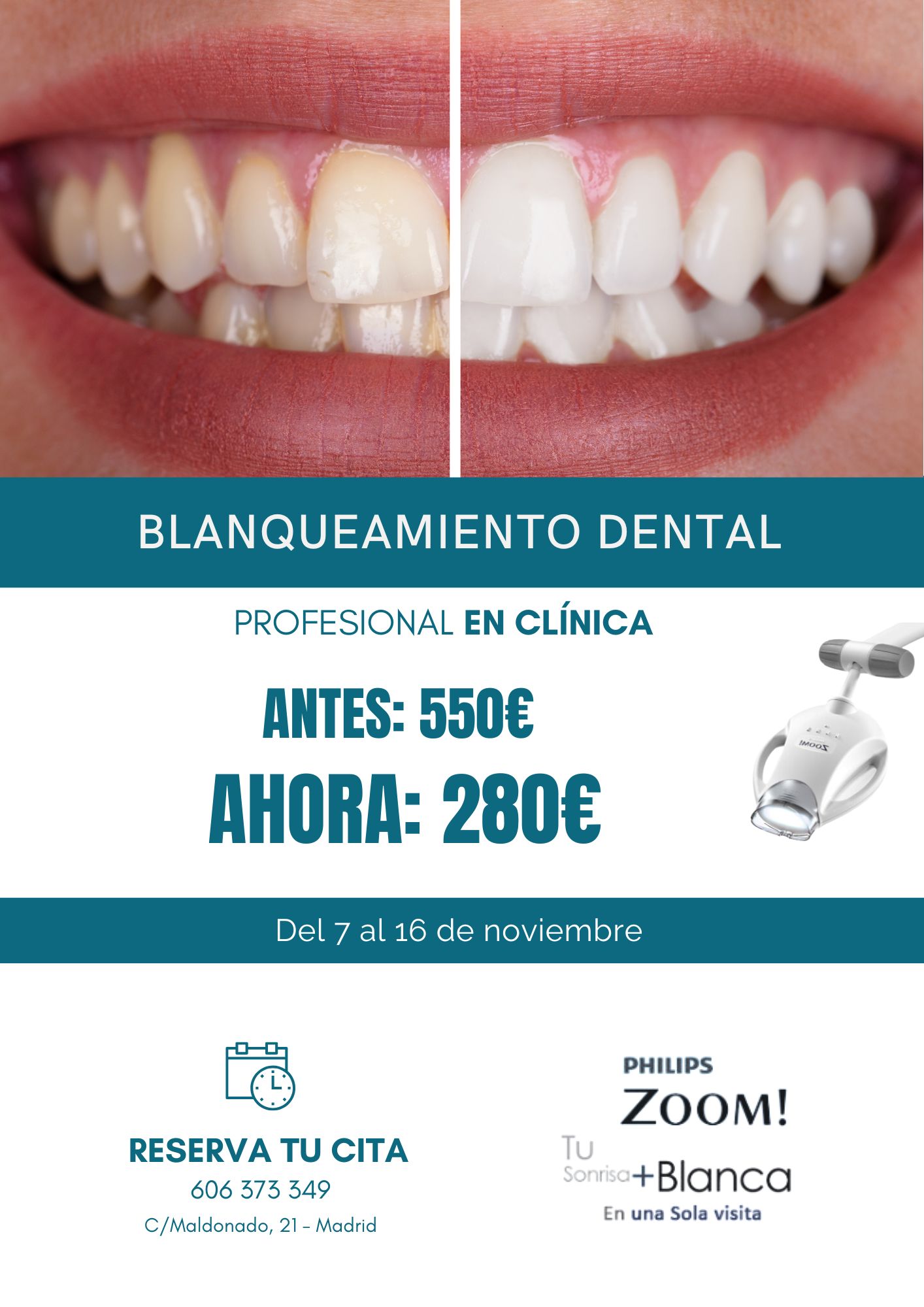 Blanqueamiento dental en clínica profesional del 7 al 16 de noviembre por solo 280 € (antes 550 €)